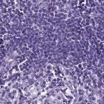 SPESP1 Antibody in Immunohistochemistry (IHC)