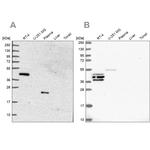 SPESP1 Antibody in Western Blot (WB)