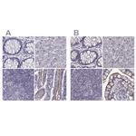 SLC28A2 Antibody in Immunohistochemistry (IHC)