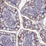 SLC28A2 Antibody in Immunohistochemistry (IHC)