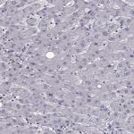 SLC28A2 Antibody in Immunohistochemistry (IHC)