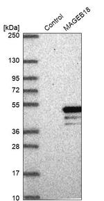 MAGEB18 Antibody in Western Blot (WB)