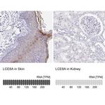 LCE6A Antibody