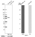 IGSF11 Antibody in Western Blot (WB)