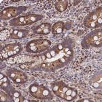 RPAP2 Antibody in Immunohistochemistry (IHC)