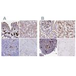 FUCA1 Antibody in Immunohistochemistry (IHC)