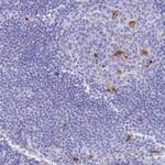 FUCA1 Antibody in Immunohistochemistry (IHC)