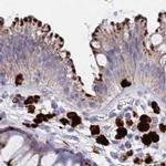 FUCA1 Antibody in Immunohistochemistry (IHC)