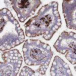 FUCA1 Antibody in Immunohistochemistry (IHC)