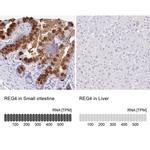 REG4 Antibody in Immunohistochemistry (IHC)