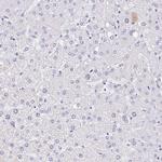 REG4 Antibody in Immunohistochemistry (IHC)