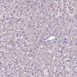 SCAMP5 Antibody in Immunohistochemistry (IHC)