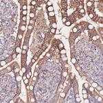 FLVCR1 Antibody in Immunohistochemistry (IHC)