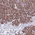 SUCLG2 Antibody in Immunohistochemistry (IHC)