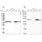 SUCLG2 Antibody in Western Blot (WB)