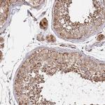 ABCB6 Antibody in Immunohistochemistry (IHC)