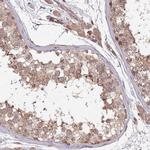 KANSL1L Antibody in Immunohistochemistry (IHC)