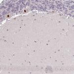 KBTBD6 Antibody in Immunohistochemistry (IHC)