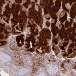 PGA3 Antibody in Immunohistochemistry (IHC)