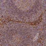 LGALS9B Antibody in Immunohistochemistry (IHC)