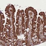 LGALS9B Antibody in Immunohistochemistry (IHC)