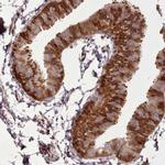 LGALS9B Antibody in Immunohistochemistry (IHC)