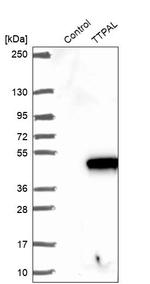 TTPAL Antibody in Western Blot (WB)