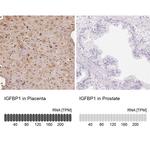 IGFBP-1 Antibody in Immunohistochemistry (IHC)