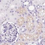 IGFBP-1 Antibody in Immunohistochemistry (IHC)