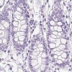 IGFBP-1 Antibody in Immunohistochemistry (IHC)