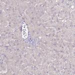 SLC44A4 Antibody in Immunohistochemistry (IHC)