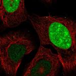 CT45A Antibody in Immunocytochemistry (ICC/IF)