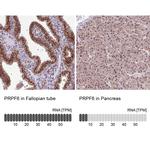 PRP6 Antibody in Immunohistochemistry (IHC)