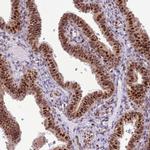 PRP6 Antibody in Immunohistochemistry (IHC)