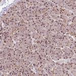 PRP6 Antibody in Immunohistochemistry (IHC)