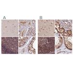 NSFL1C Antibody in Immunohistochemistry (IHC)