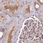 NSFL1C Antibody in Immunohistochemistry (IHC)