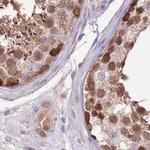 NSFL1C Antibody in Immunohistochemistry (IHC)