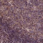 NSFL1C Antibody in Immunohistochemistry (IHC)