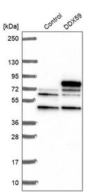 DDX59 Antibody in Western Blot (WB)