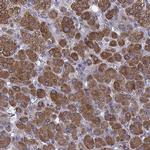 SOAT1 Antibody in Immunohistochemistry (IHC)