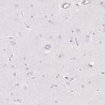 SOAT1 Antibody in Immunohistochemistry (IHC)