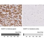 SOAT1 Antibody