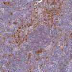 Galectin 9 Antibody in Immunohistochemistry (IHC)