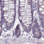 NAPSA Antibody in Immunohistochemistry (IHC)