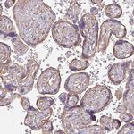 MYH10 Antibody in Immunohistochemistry (IHC)