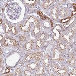 MYH10 Antibody in Immunohistochemistry (IHC)