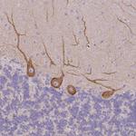 MYH10 Antibody in Immunohistochemistry (IHC)