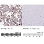 MYH10 Antibody