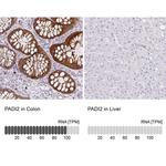 PADI2 Antibody in Immunohistochemistry (IHC)